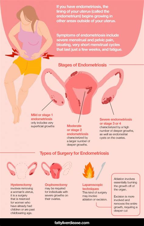 endometriosis and pregnancy after surgery